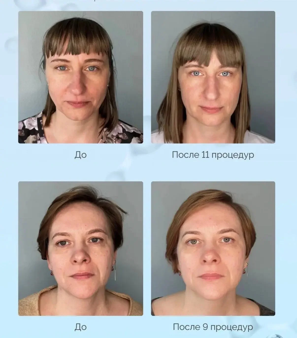 Примеры фотографий до и после курсов БМС