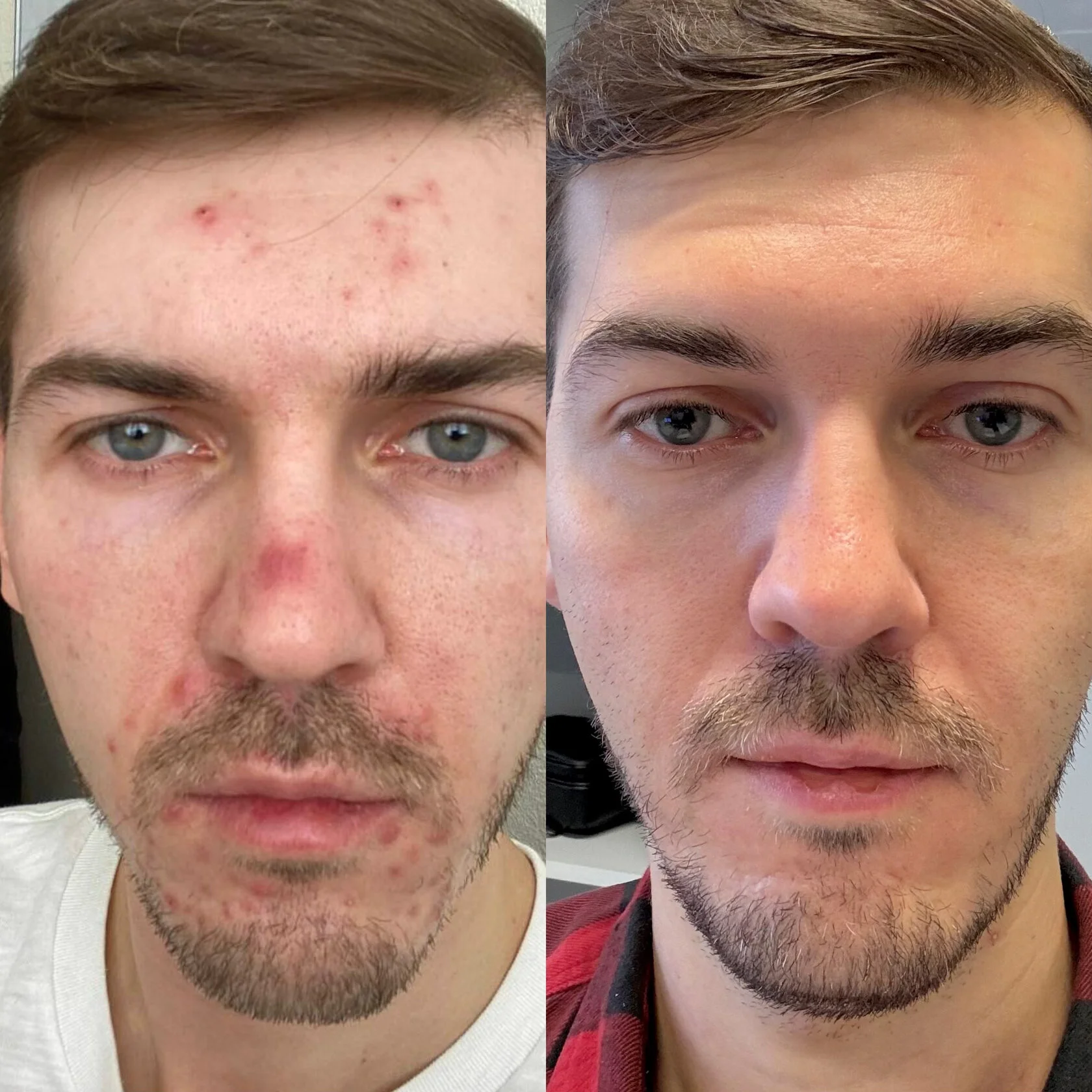 Кейс 1 до и после