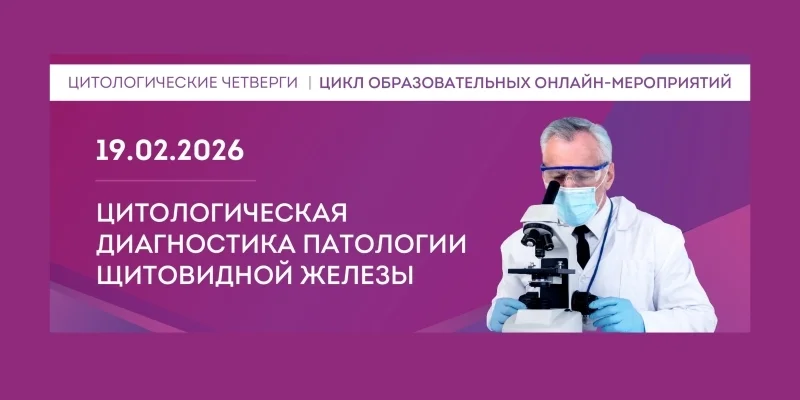 Циточетверг