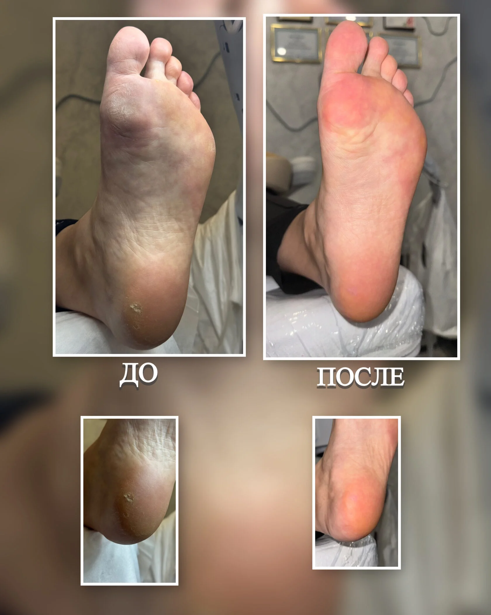 Подология