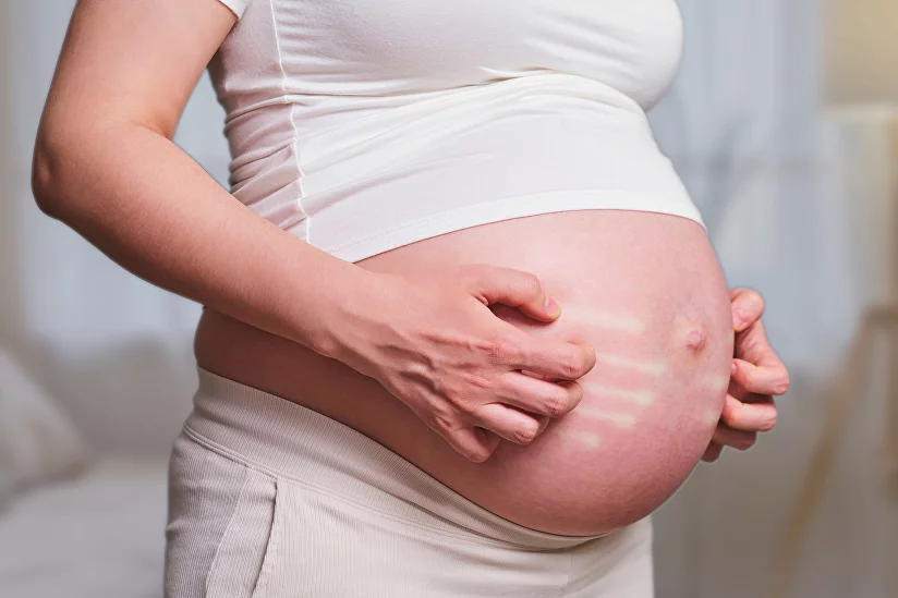 Проблемы с кожей во время беременности: причины и пути решения