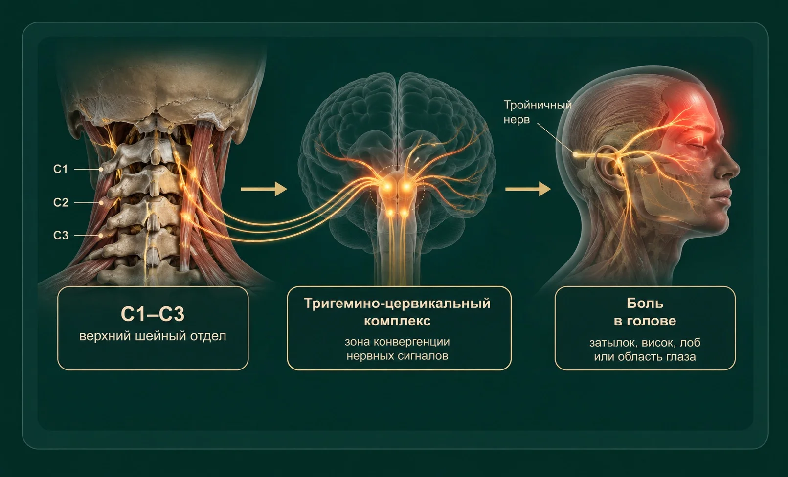 Тригеминоцервикальная конвергенция и передача болевой импульсации из C1–C3 в область головы