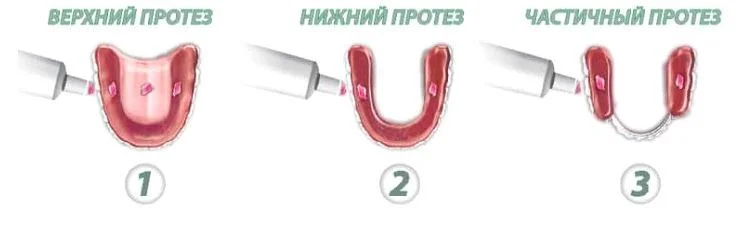 Схема нанесения крема для фиксации зубных протезов