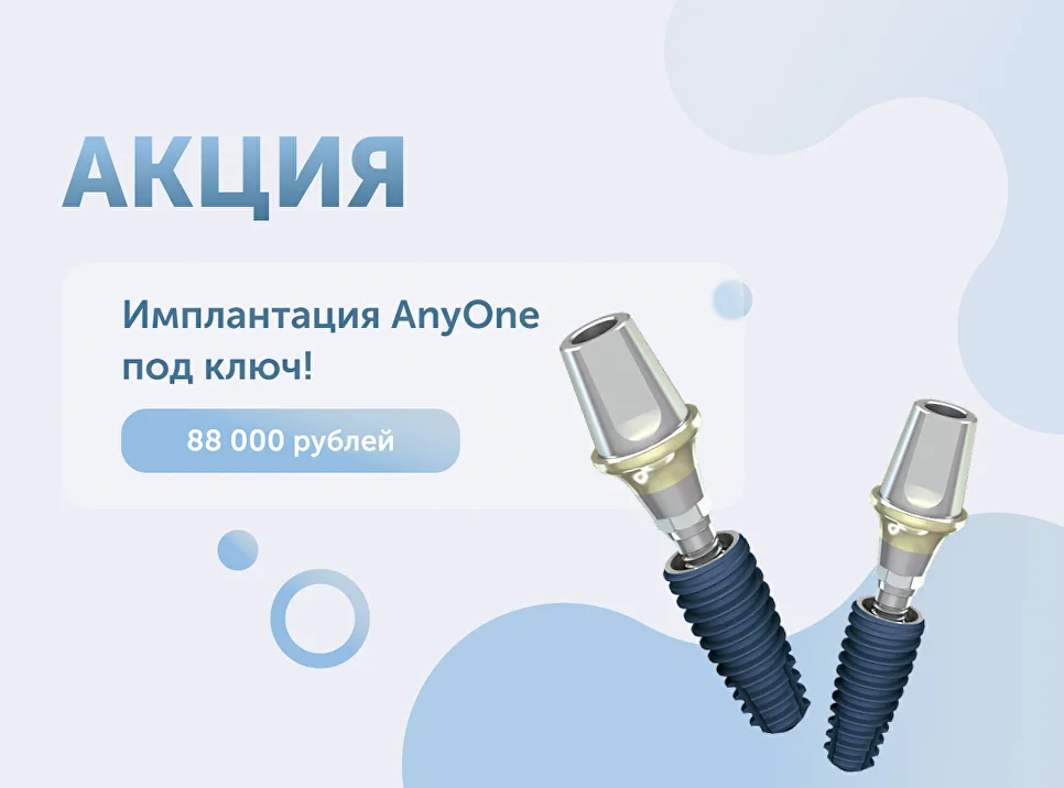 Импланты AnyOne