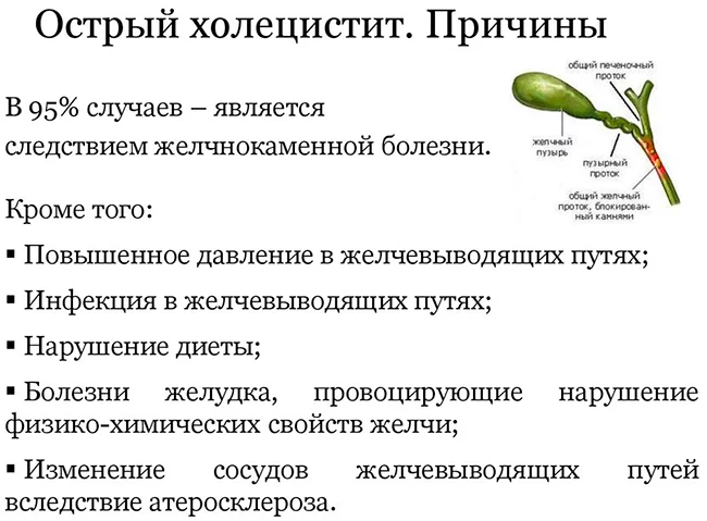 Хронический холецистит – симптомы, причины, признаки и методы лечения у взрослых в «СМ-Клиника»