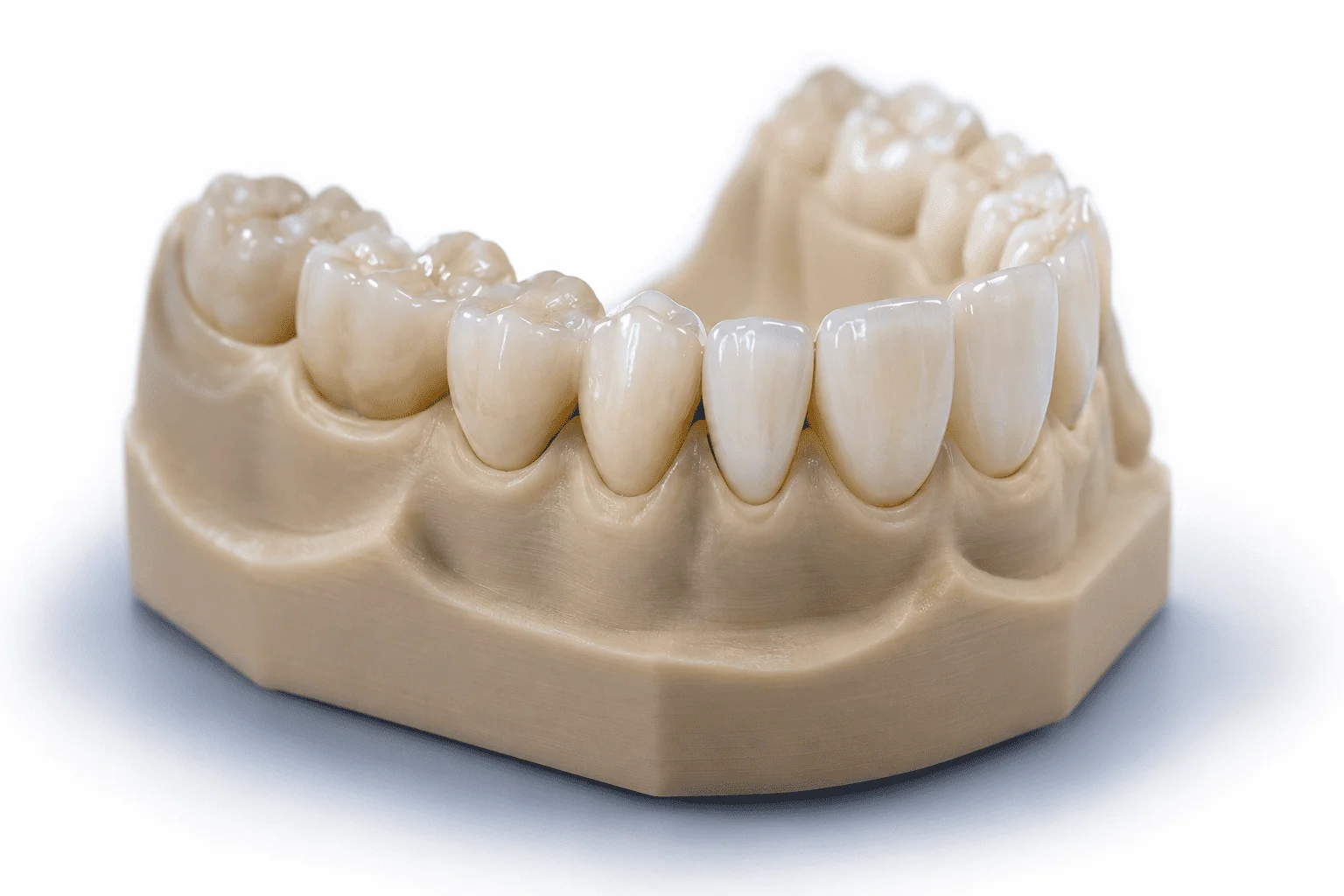 Коронки из диоксида циркония и керамики на напечатанной 3D-модели