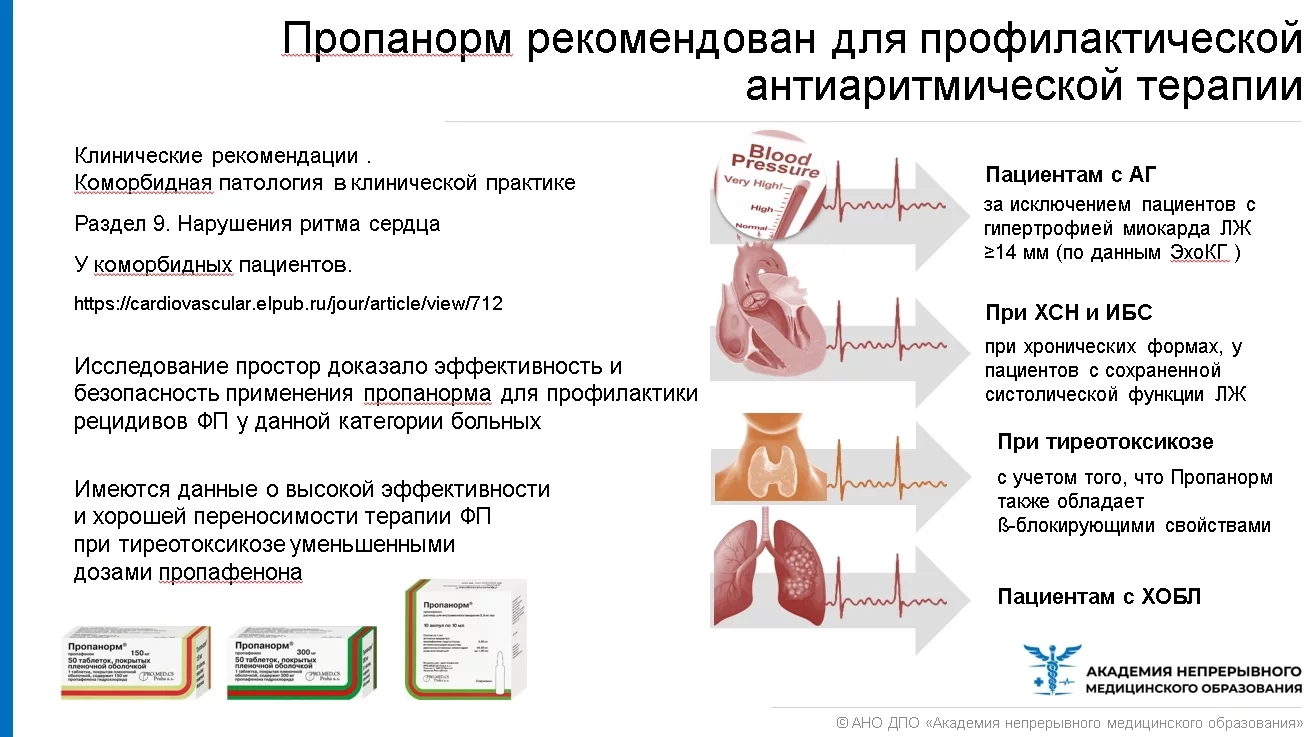 Лечение мерцательной аритмии (в амбулаторных условиях)