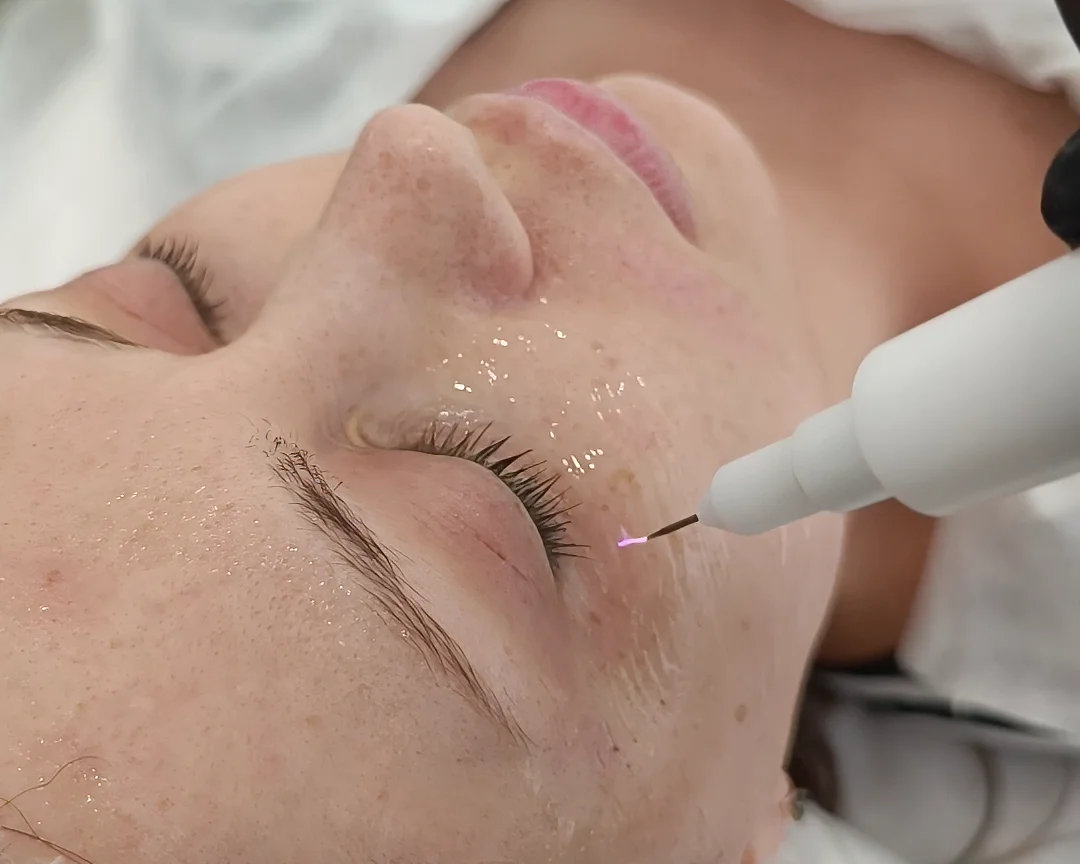 Холодная плазма