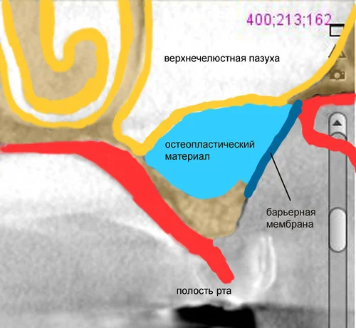 Схема заполнения