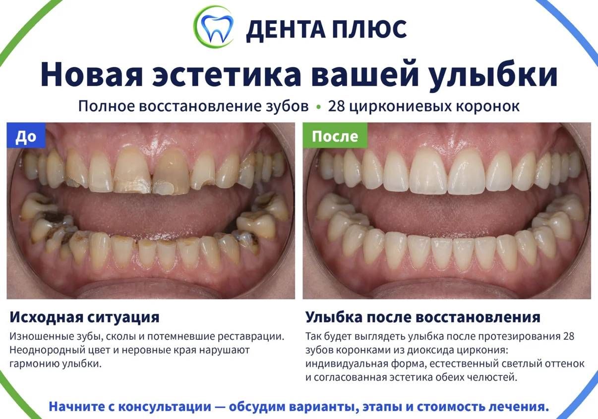 Работа клиники «Дента Плюс», пациент 2