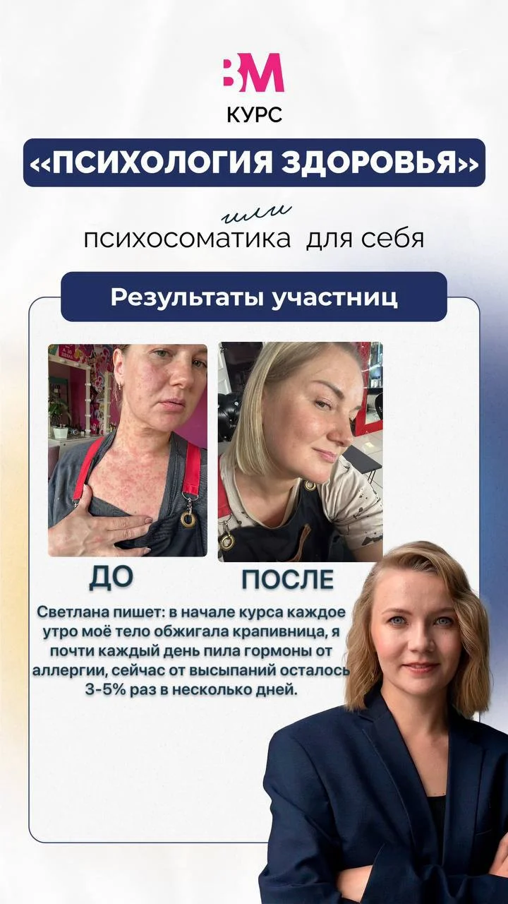 Крапивница