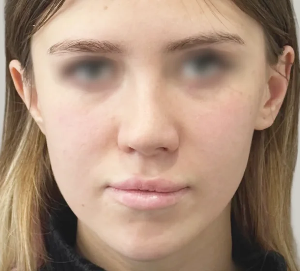 До
