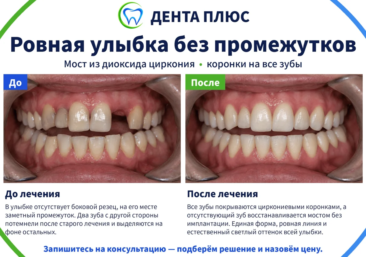 Работа клиники «Дента Плюс», пациент 4