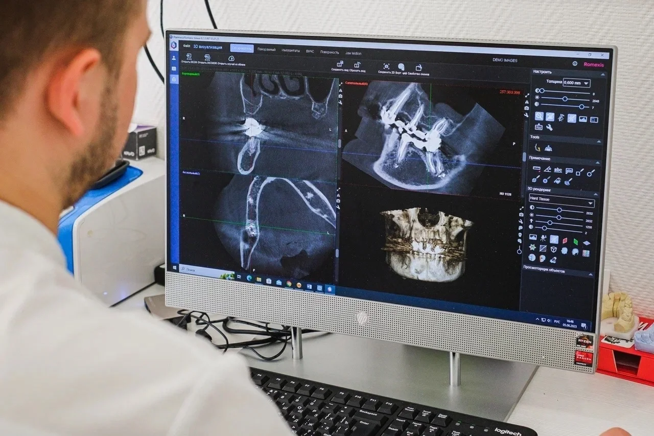 3D-диагностика