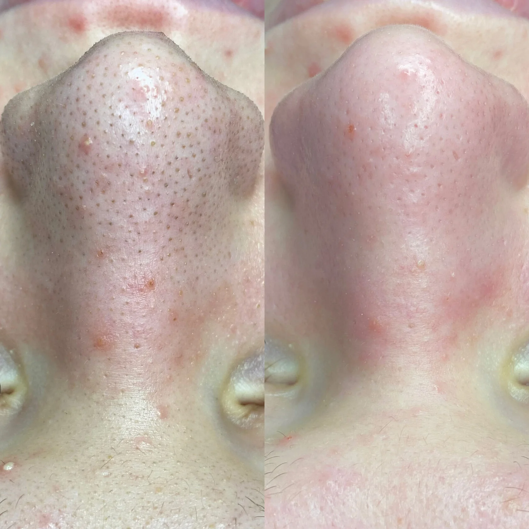 Кейс 6 до и после