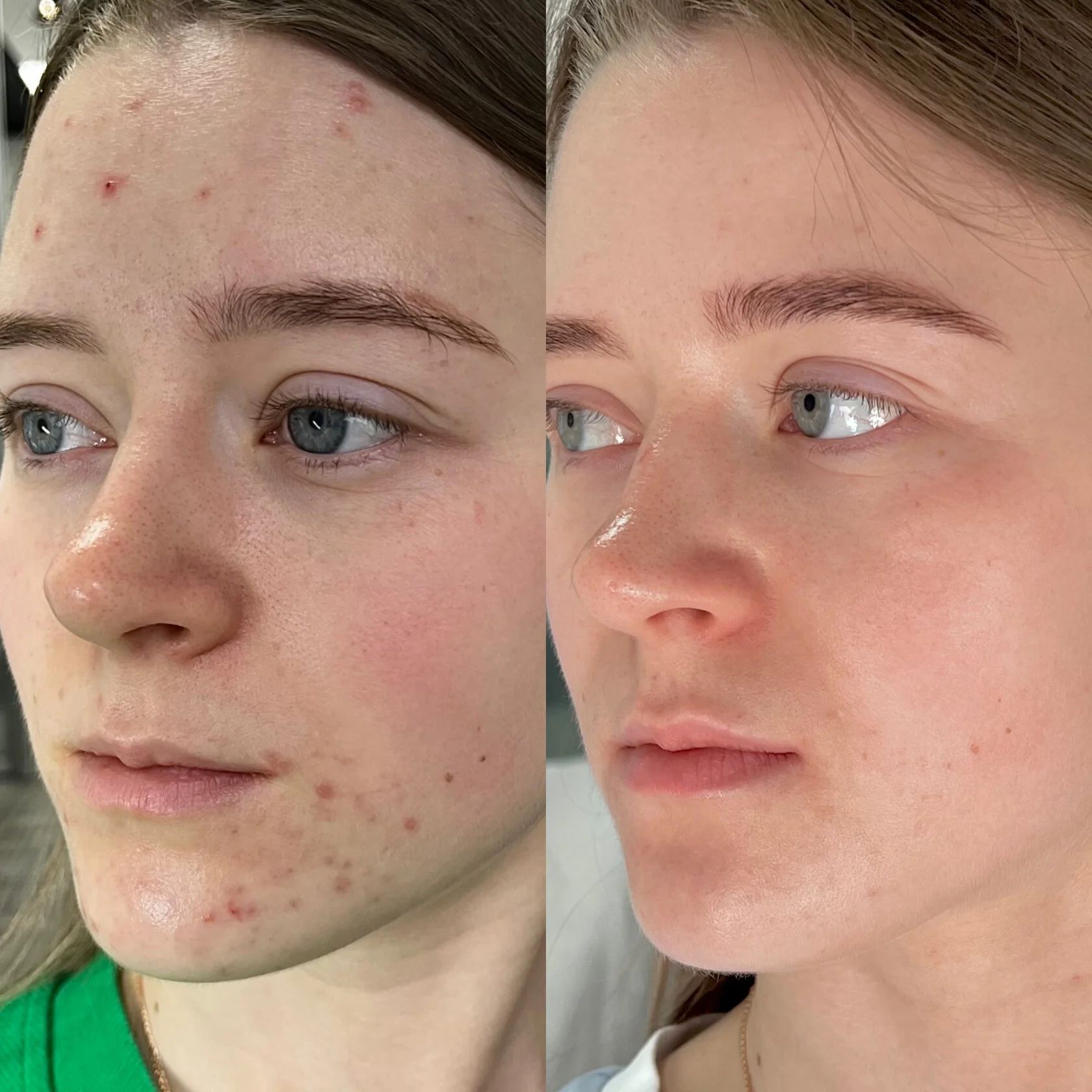 Кейс 3 до и после