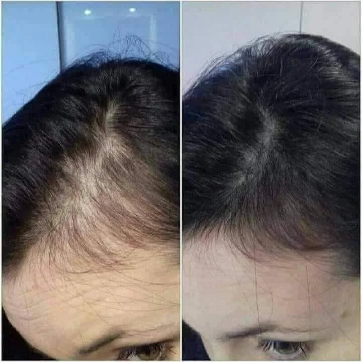 Уходовые процедуры