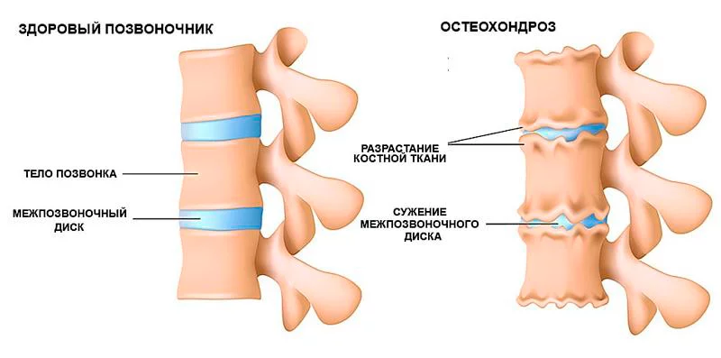 Как уменьшить боль от инъекции и установки сенсора или канюли | Блог интернет-магазина Диамарка