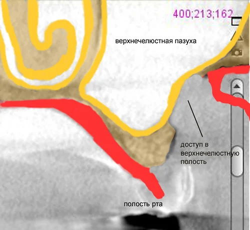 Схема окошка