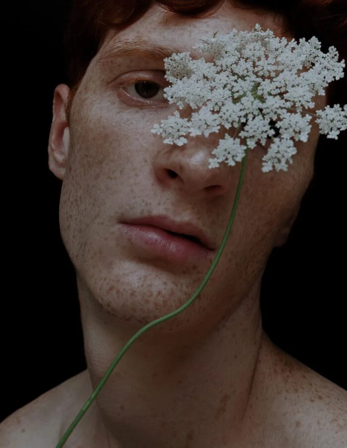 Conceptual portrait of a freckled model framed by a white flower
