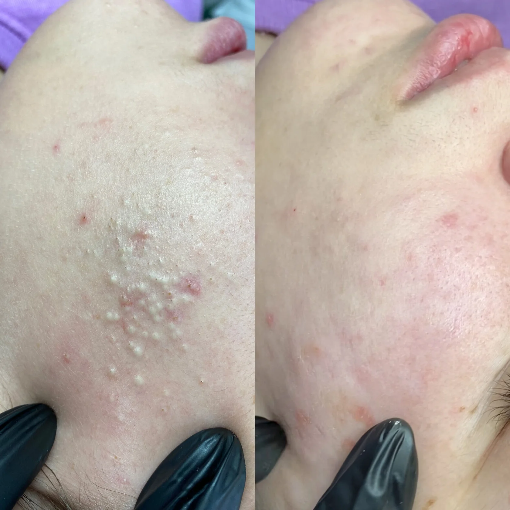 Кейс 5 до и после