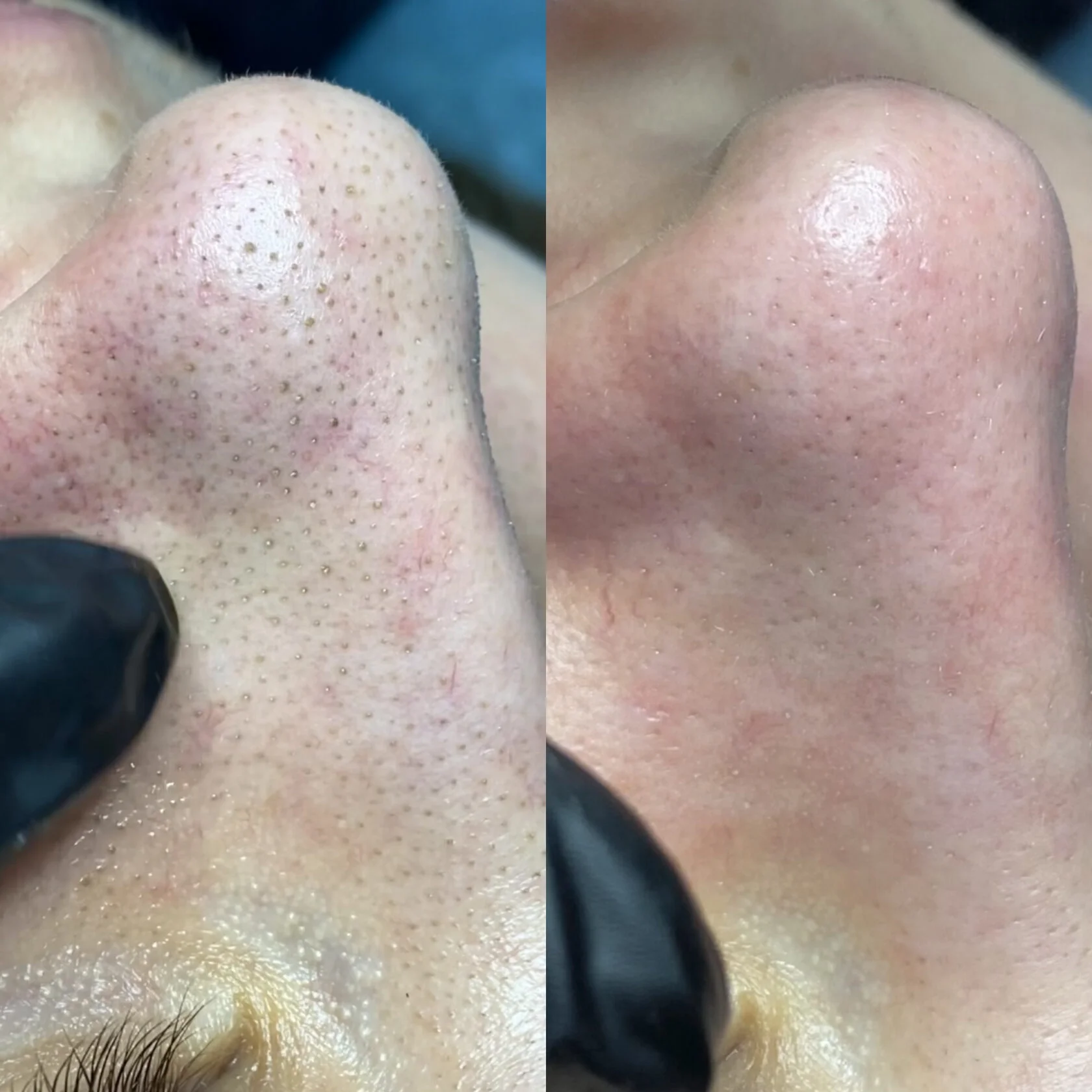 Кейс 2 до и после