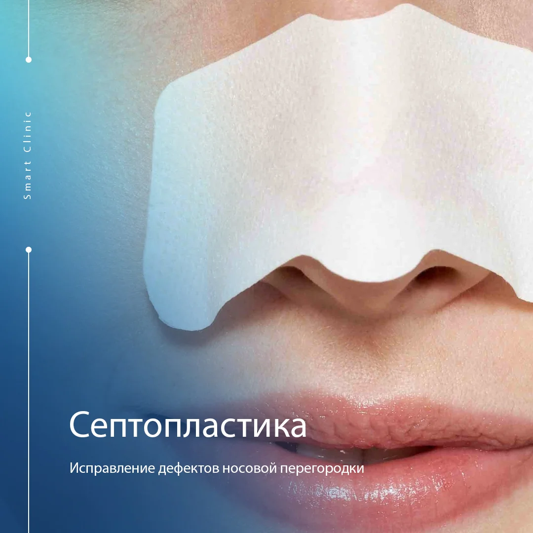 Smart Clinic. Медицинский центр Тольятти