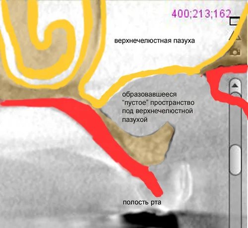 Схема