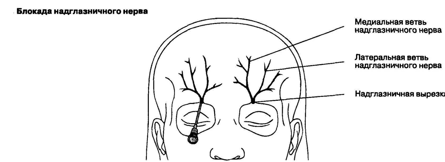 Блокада тройничного нерва – показания, особенности проведения