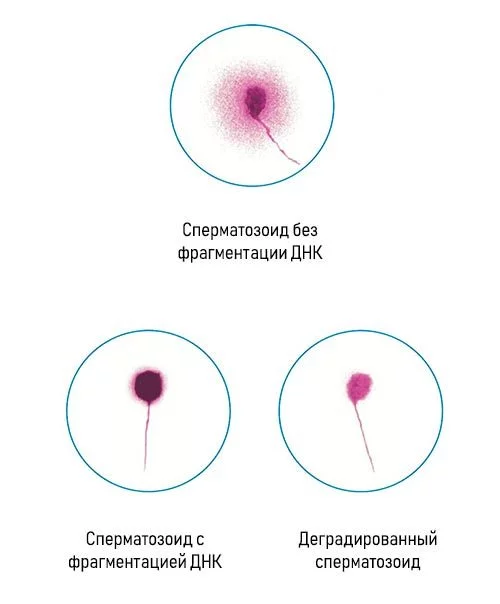 Подвижность сперматозоидов и их активность у мужчин: причины низкой, как повысить