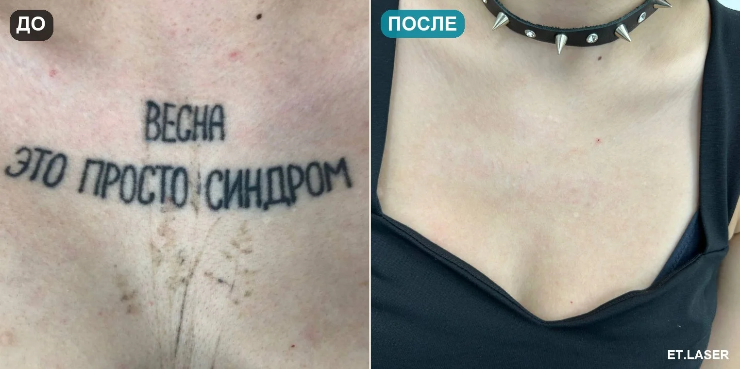 До и после: надпись на груди