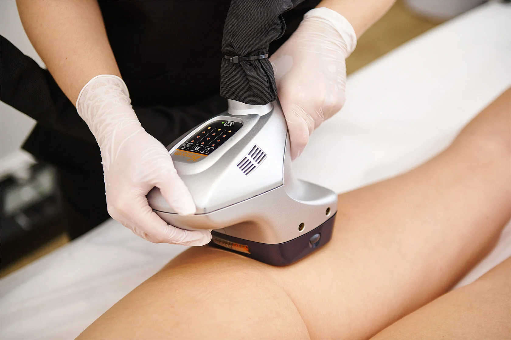 VelaShape II — коррекция фигуры