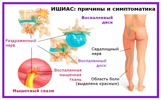 Попали в нерв?