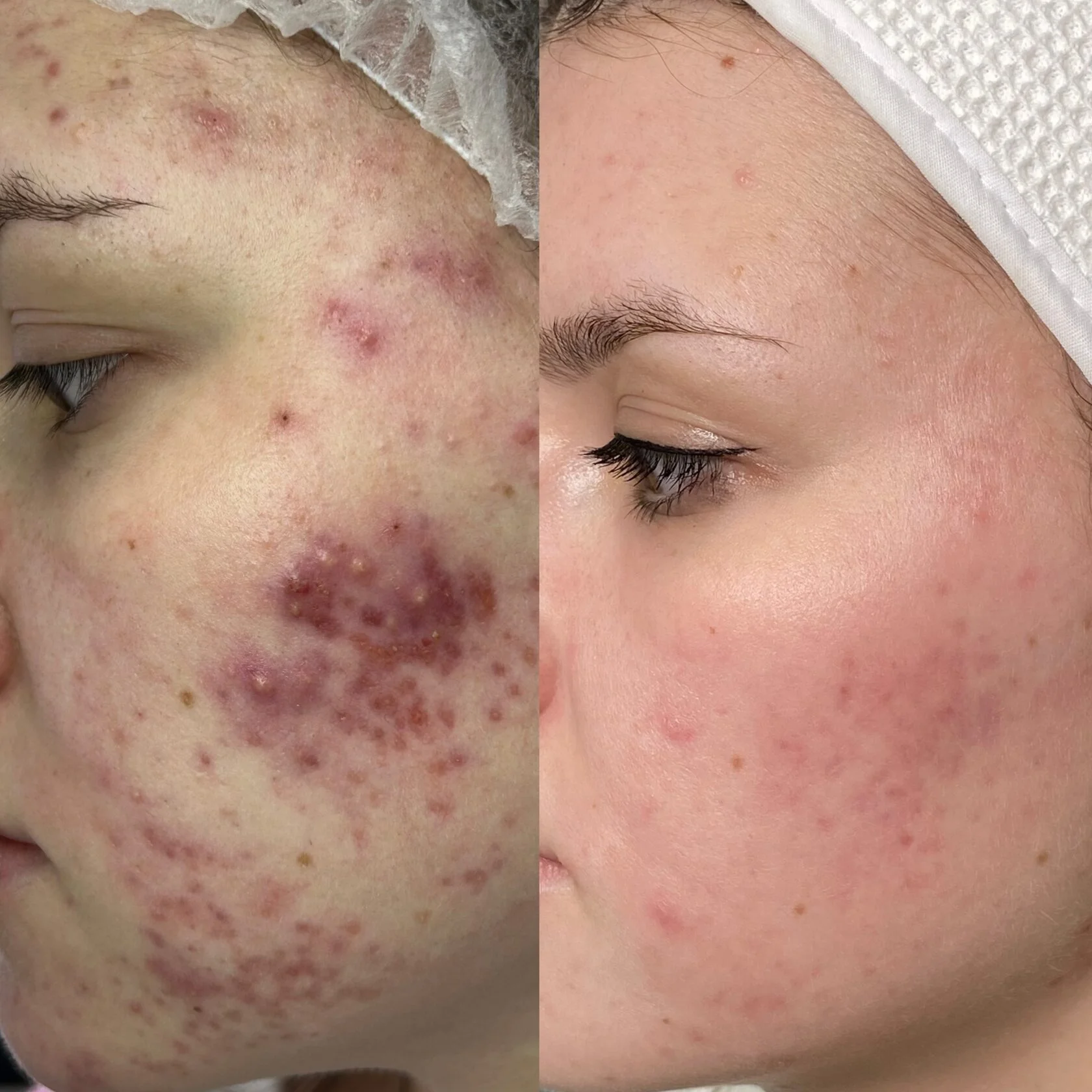 Кейс 4 до и после