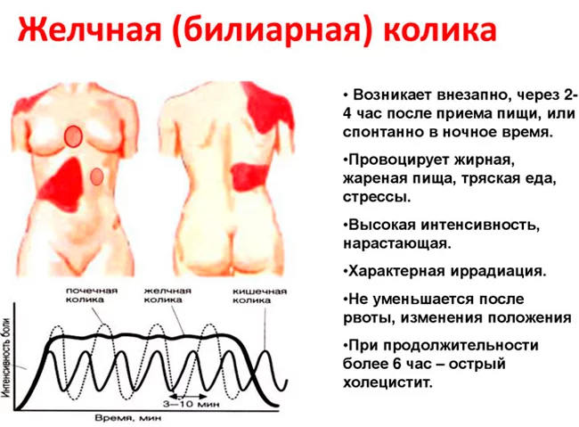 Холецистит: симптомы и лечение: симптомы, причины, диагностика и лечение