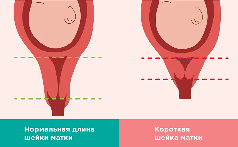 глубина влагалища 