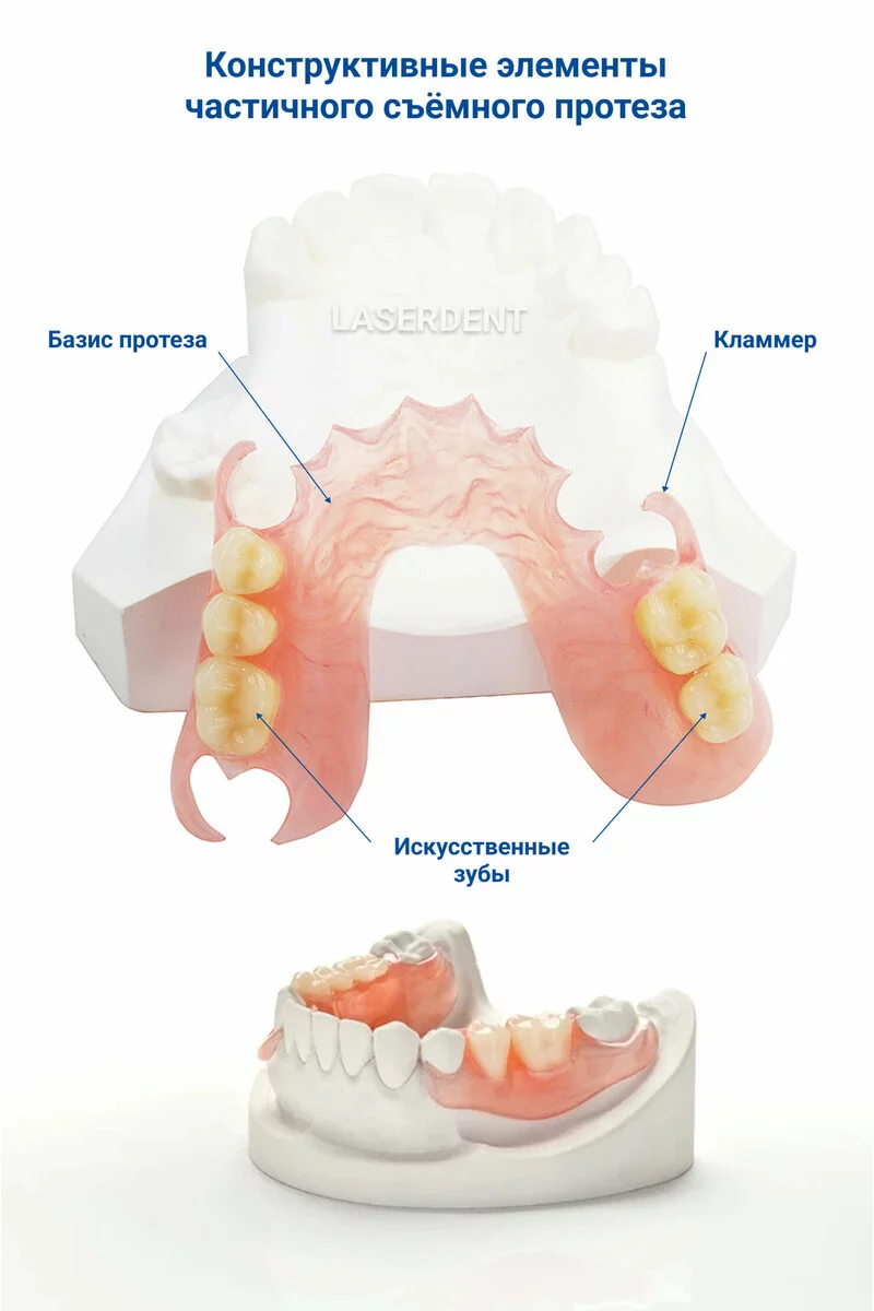 Частично съемный зубной протез на верхнюю и нижнюю челюсть, цена р