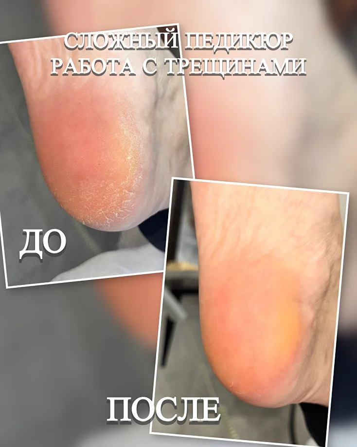 Подология
