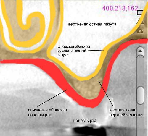 Схема операции