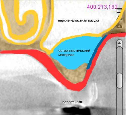 Швы