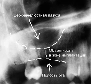 Жалобы пациента 2