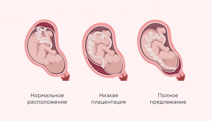 Секс во время беременности: быть или не быть.