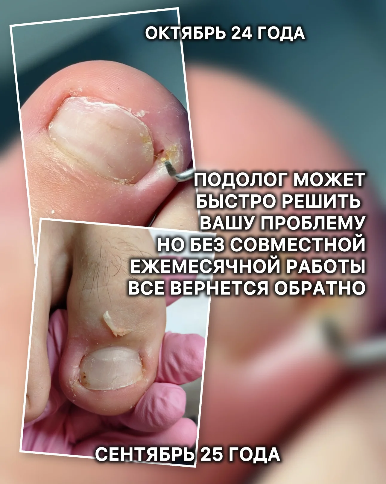 Подология