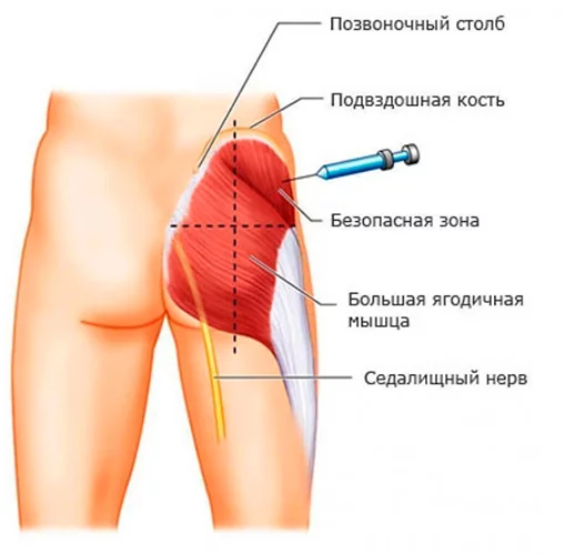 Какой врач лечит боль в руке после укола